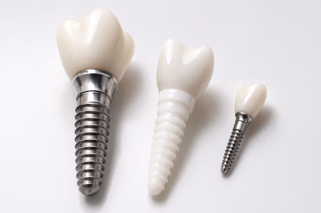 Titan- Keramik- und Miniimplantat im direkten Materialvergleich